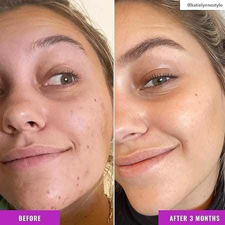 Niacinamide Brightening Toner – Image 7