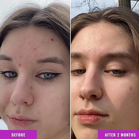 Niacinamide Serum – Image 5
